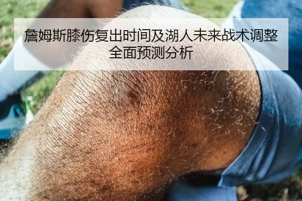 詹姆斯膝伤复出时间及湖人未来战术调整全面预测分析 - KAIYUAN GAMES
